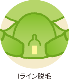 Iライン脱毛